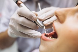 Como um odontólogo iniciante pode captar seus primeiros clientes?