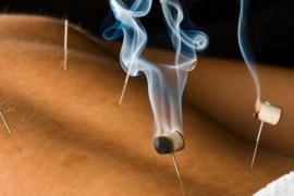 Como a acupuntura pode impactar o sucesso do empreendedor?